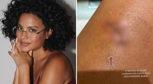 Bella Campos revela qual foi maior dificuldade que enfrentou ao gravar uma novela: 'Mordida de jacaré'