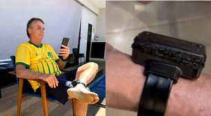 Jair Bolsonaro violou tornozeleira eletrônica após ouvir vozes no dispositivo, dizem pessoas próximas