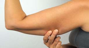 Anticoncepcionais causam flacidez muscular? Veja o motivo