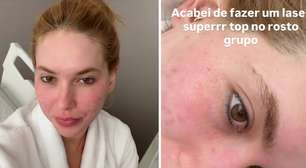 Virgínia desmente boatos de cirurgia no rosto e afirma: 'Foi só laser mesmo'