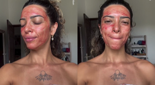 Máscara com sangue menstrual funciona ou é perigosa? Veja o que diz dermatologista