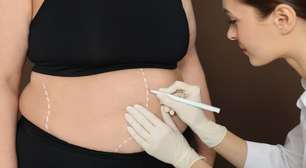 Dores, infecções e assaduras após a bariátrica. Como a cirurgia reparadora faz parte do tratamento?