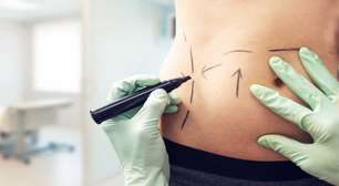 Cirurgia traz autoestima após o parto: o que é o mommy makeover?