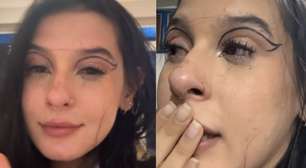 Após críticas, Ana Castela passa por cirurgia e especialista alerta: 'Extremamente precisa'