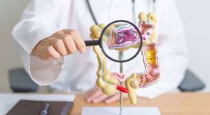 Câncer colorretal: diagnóstico tardio ainda é regra no país