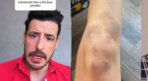 Caso Calvo do Campari: Thiago Schutz sai da prisão após denúncia de agressão contra a namorada; defesa da vítima aponta chutes e tentativa de estupro