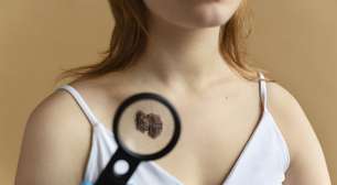 Câncer de pele deve bater novos recordes em 2025