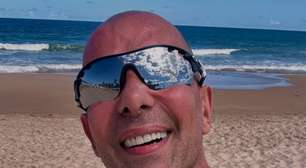 'Mais de 12 mil fios de cabelo': médico explica transplante capilar de Rafael Ilha, diagnosticado com calvície avançada em grau 7