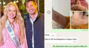 Prints! Ex de Dado Dolabella revela que sofreu diversas agressões do ator