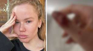 Ex de Dado Dolabella divulga novos registros de agressões; imagens fortes