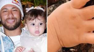Dedo da filha de Neymar surpreende em nova foto e recuperação impressiona após cirurgia urgente