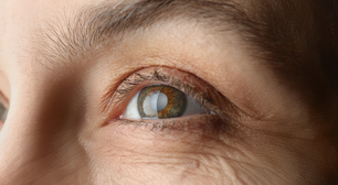 Aquecimento global causa 20% dos casos de catarata, diz OMS