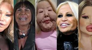 Caso Juju do Pix: além da influencer, outras 17 famosas já exageraram em procedimentos e ficaram com rosto completamente diferente