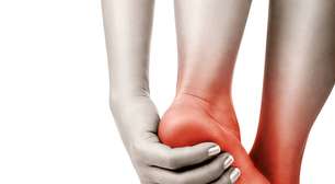 Beleza que custa caro: o risco de usar saltos altos demais