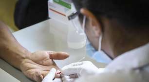 Entre altos índices e novos avanços: Porto Alegre mantém maior mortalidade por Aids entre capitais