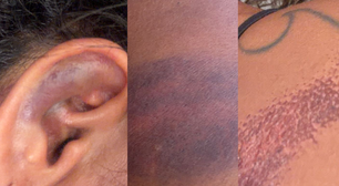 PMs são afastados após denúncia de agressão contra advogada durante festa no RN