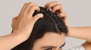 O erro mais comum no banho que piora a sua caspa (e quase ninguém sabe)