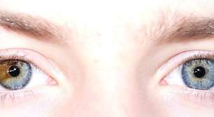 Heterocromia: causas, tipos e curiosidades sobre a diferença de cor nos olhos
