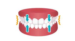 Por que rangemos os dentes? Tudo sobre bruxismo