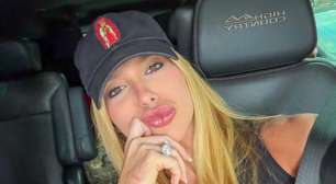 'Toda hora que eu acho que vai melhorar...': rainha de bateria da Grande Rio, Virgínia Fonseca revela problemas na pele com condição envolvendo o Carnaval