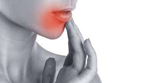 Afta: por que surge, como prevenir e o que fazer para aliviar mais rápido