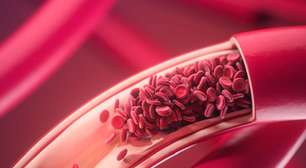 Como o calor e as viagens podem aumentar o risco de trombose no fim de ano