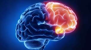 Kim Kardashian descobre baixa atividade cerebral; entenda o alerta médico