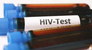 HIV e condições proctológicas: aumento de risco em pacientes soropositivos