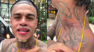 'Tentaram levar meu cordão': MC Cabelinho relata confusão no Pelourinho