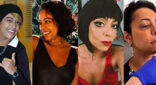 A transformação de Samantha Schmütz: atriz impressiona com novo visual após procedimento com médico de Kim Kardashian; veja 27 fotos do antes e depois!