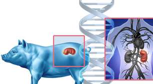 Por que colocar órgãos de porcos em pessoas é aceitável, mas cultivar órgãos humanos em porcos não é?