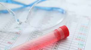 Polêmica ou salvação? Exame toxicológico já barrou 300 mil motoristas drogados, segundo dados