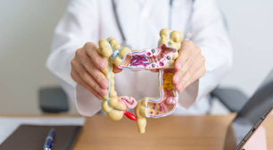 Crescem casos de diverticulite em adultos com menos de 50 anos