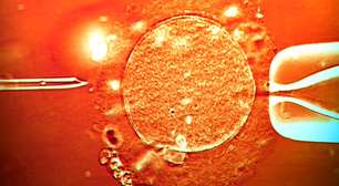 Esperma de doador com mutação que causa câncer foi usado para concepção de quase 200 crianças na Europa