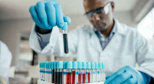 Novo exame de sangue com três etapas pode prever o risco de ataque cardíaco