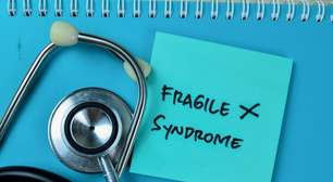 Síndrome do X Frágil: conheça as causas e os sintomas