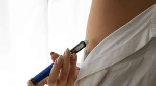 Caneta emagrecedora substitui bariátrica? Médica responde