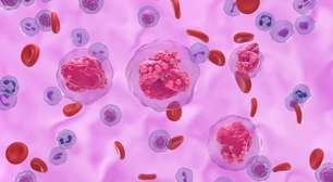 O novo tratamento que salva vidas na luta contra a leucemia