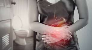 Isquemia intestinal: entenda a "falta de sangue no intestino"