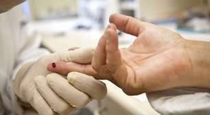 Rio registra menor índice de contaminação por HIV desde 2014