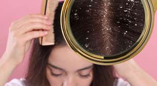 Esqueça a caspa no verão: é verdade que lavar o cabelo todo dia piora a doença? Veja o que dizem especialistas!