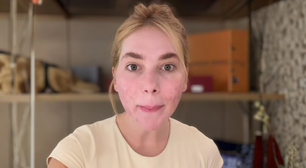 Deu ruim? Virgínia se arrepende após novo procedimento estético antes das festas de fim de ano e agita a web: 'Rosto pipocado'