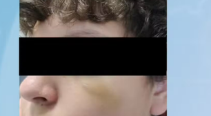 Adolescente brasileiro é agredido em escola em Portugal: 'Levei um murro e desmaiei'