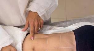 Tratamentos estéticos que ainda podem ser feitos em 2025