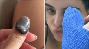 Atriz Carol Macedo prende o dedo na porta do carro e precisa passar por cirurgia