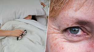 Você dorme de barriga para cima para evitar rugas? Saiba que o efeito é exatamente o contrário