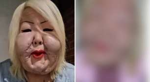 OUTRA PESSOA! Veja antes e depois de Juju do Pix, influencer tirou óleo mineral do rosto