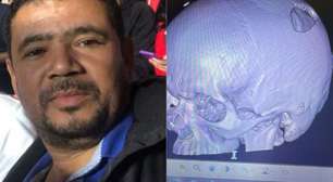 São Paulo e Conmebol terão de pagar pensão de R$ 8 mil a torcedor atingido por placa no estádio