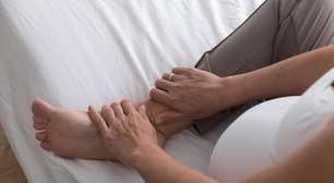 Calor agrava insuficiência venosa e acende alerta no verão