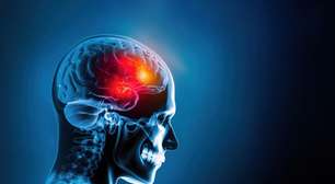 Brasil inicia estudo inédito para mapear genética do AVC e aprimorar cuidado no SUS